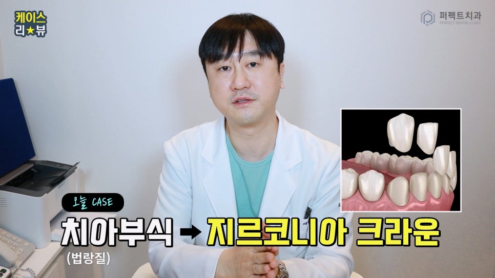 치아부식으로 크라운까지 하게 된 이유는? 관련 이미지 9