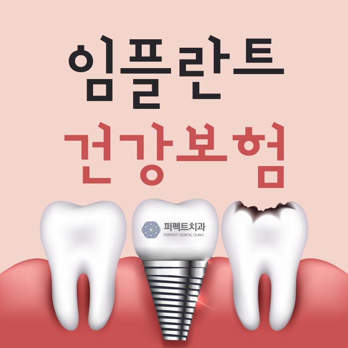 임플란트 건강보험 적용하면? 관련 이미지 1