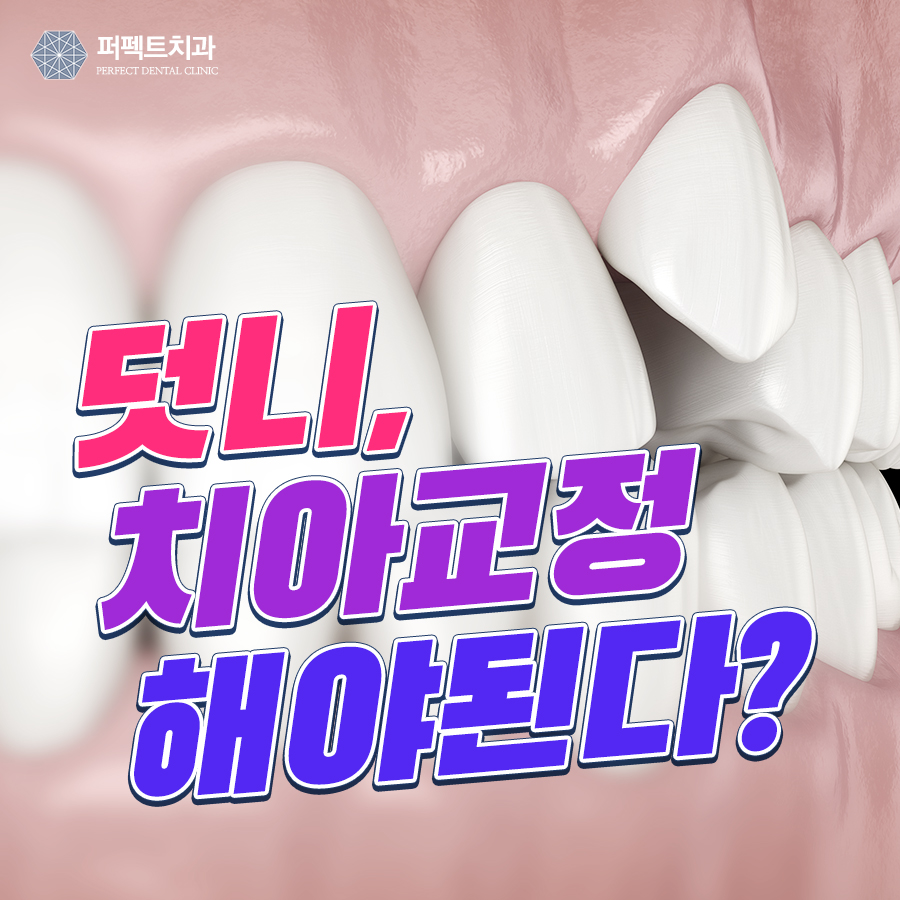 덧니교정,발치 꼭 해야되나요? 관련 이미지 1