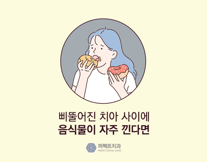 입냄새 이제 안녕~ 구취제거 어떻게? 관련 이미지 5