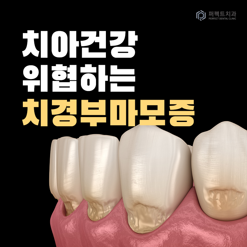 치아건강 위협하는 치경부마모증 관련 이미지 1