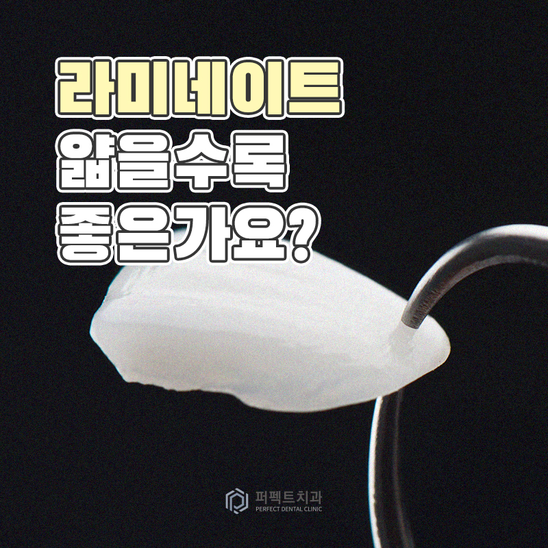 라미네이트 얇을수록 좋은가요? 관련 이미지 1