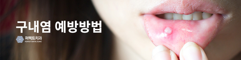 유아 구내염 원인, 치료법 관련 이미지 3