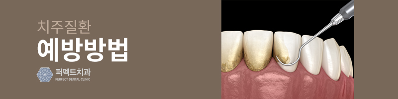 치주질환 예방법은 스케일링? 관련 이미지 3
