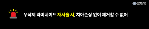 무삭제라미네이트 치료의 문제점? 관련 이미지 2