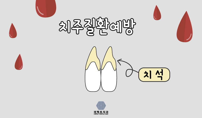 치실 사용법 제대로 알고 사용하자~ 관련 이미지 5