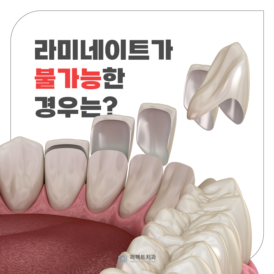 라미네이트를 하면 안되는 경우도 있다? 관련 이미지 1