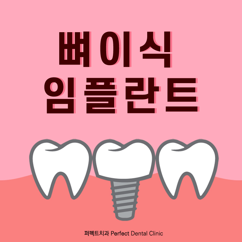 뼈이식임플란트란 뭘까? 관련 이미지 1