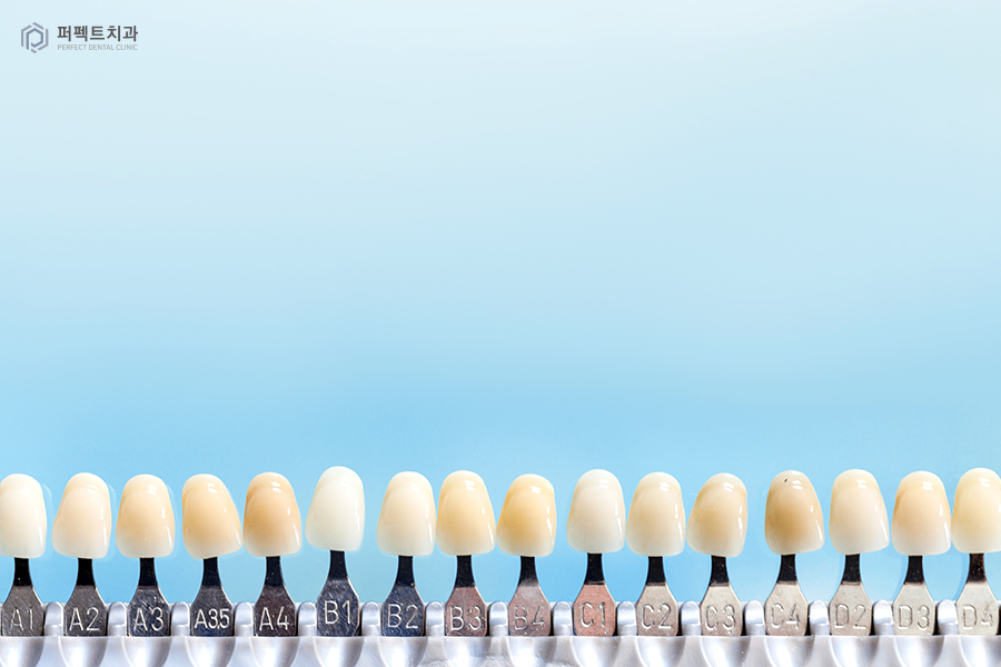 라미네이트를 해야한다면? 색상, 모양을 결정하는 tip! 관련 이미지 6