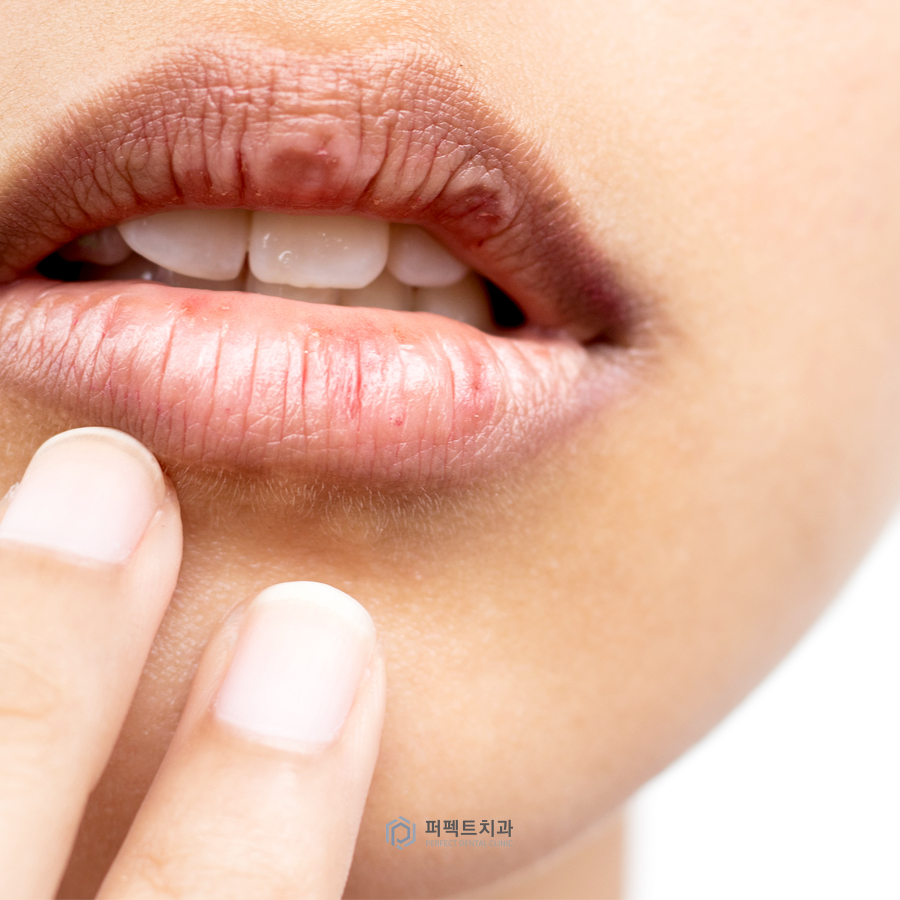 짧은 치아를 개선하는 방법은? 관련 이미지 2