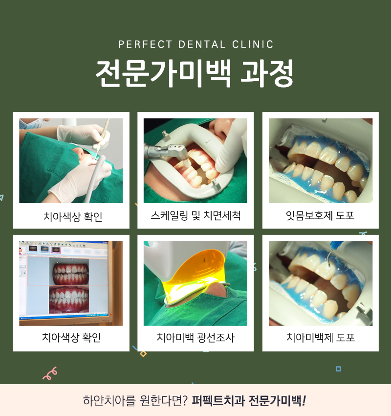 1일 3회로 치아미백 하루만에 끝! 관련 이미지 5