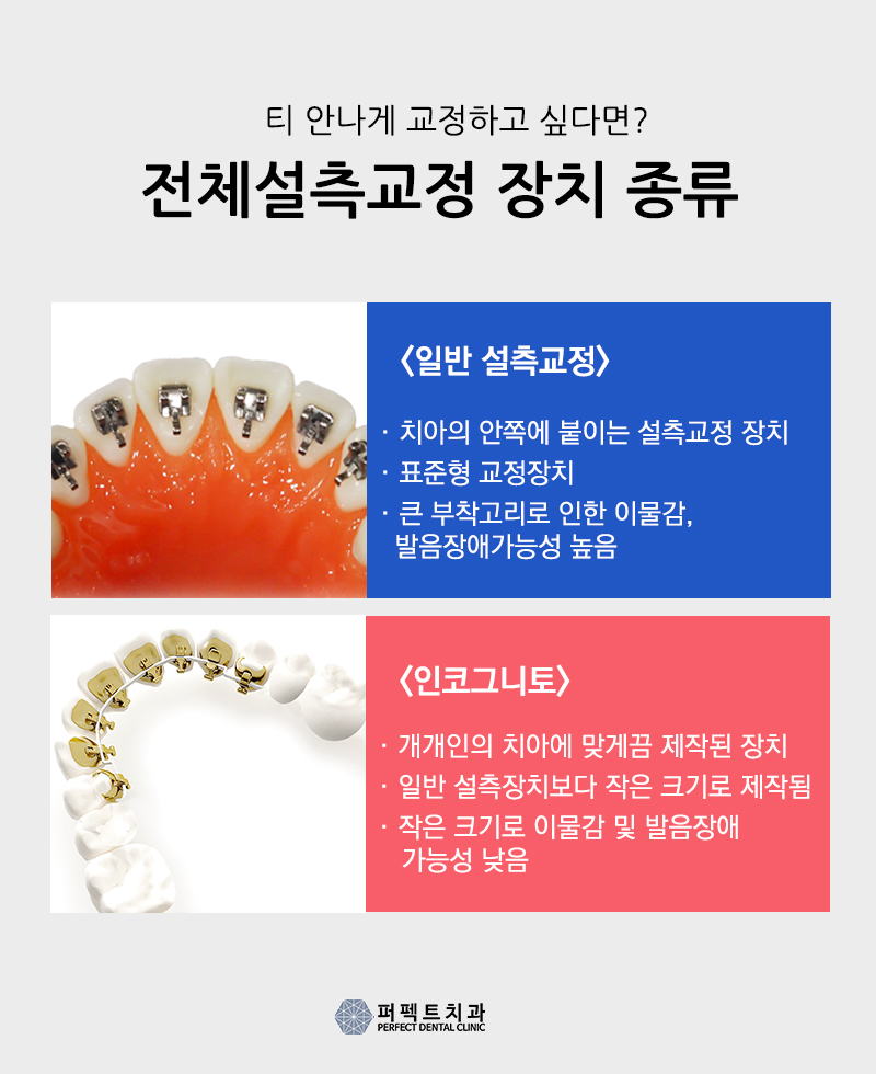 콤비교정에 대해 궁금해요 관련 이미지 3