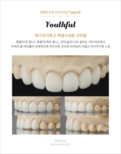 강남역치과, 앞니 라미네이트 가격 관련 이미지 4
