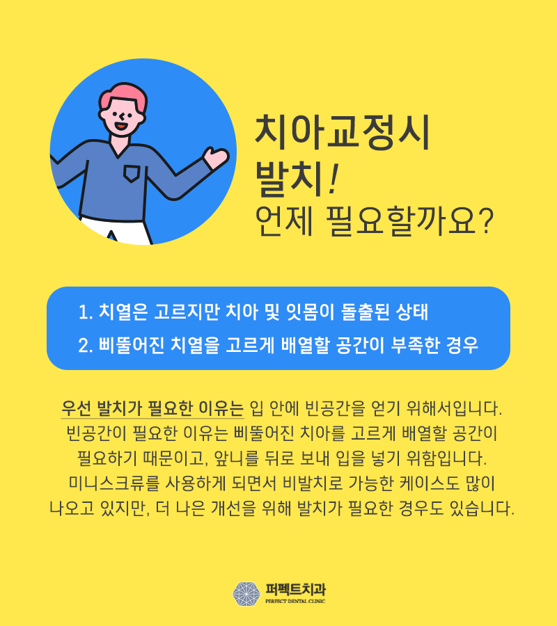 자가결찰 클리피씨전체교정 비용은 어떻게? 관련 이미지 4