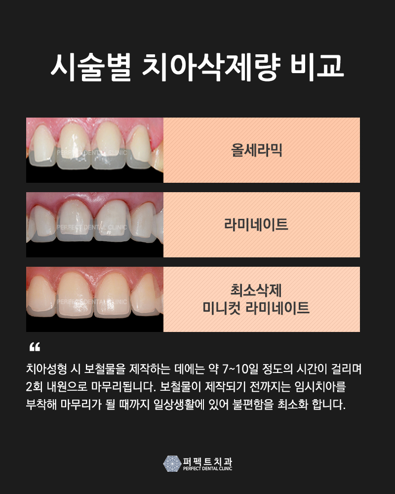퍼펙트치치과 "0.1mm 미니컷 라미네이트" 관련 이미지 1
