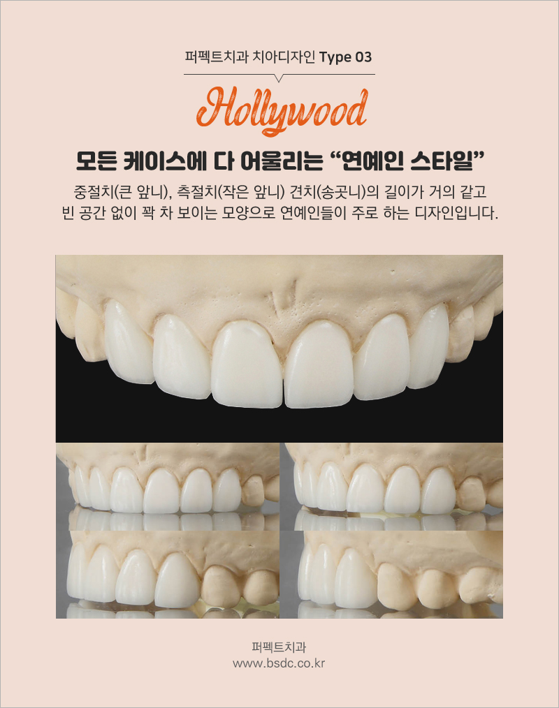 강남 최소삭제라미네이트 알아주는 치과 관련 이미지 10