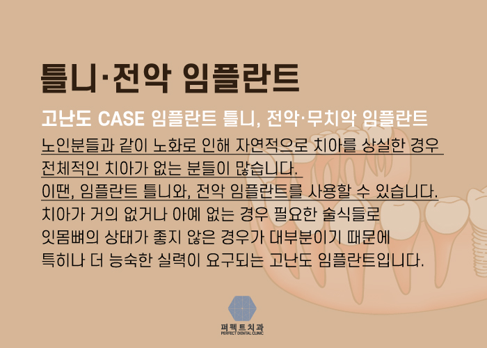 전체임플란트 고민되는데.. 관련 이미지 6