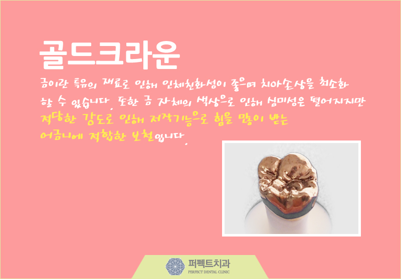 다시돌아온 지르코니아 크라운! 관련 이미지 6