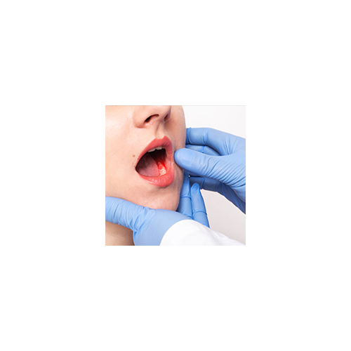 치아 염증을 알리는 증상들 관련 이미지 3