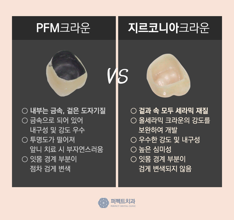 선릉역 어금니 지르코니아 가격 관련 이미지 7