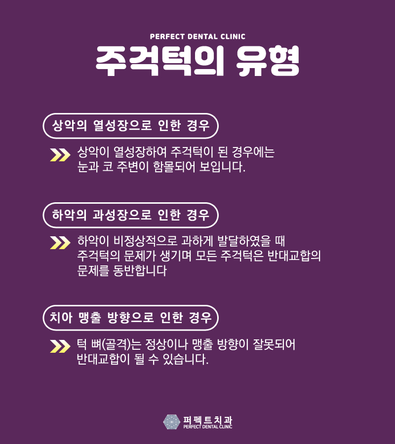 주걱턱교정 치료방법 관련 이미지 3