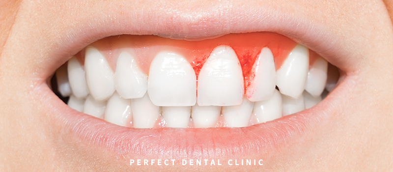 잇몸상태 자가진단 테스트! 관련 이미지 1