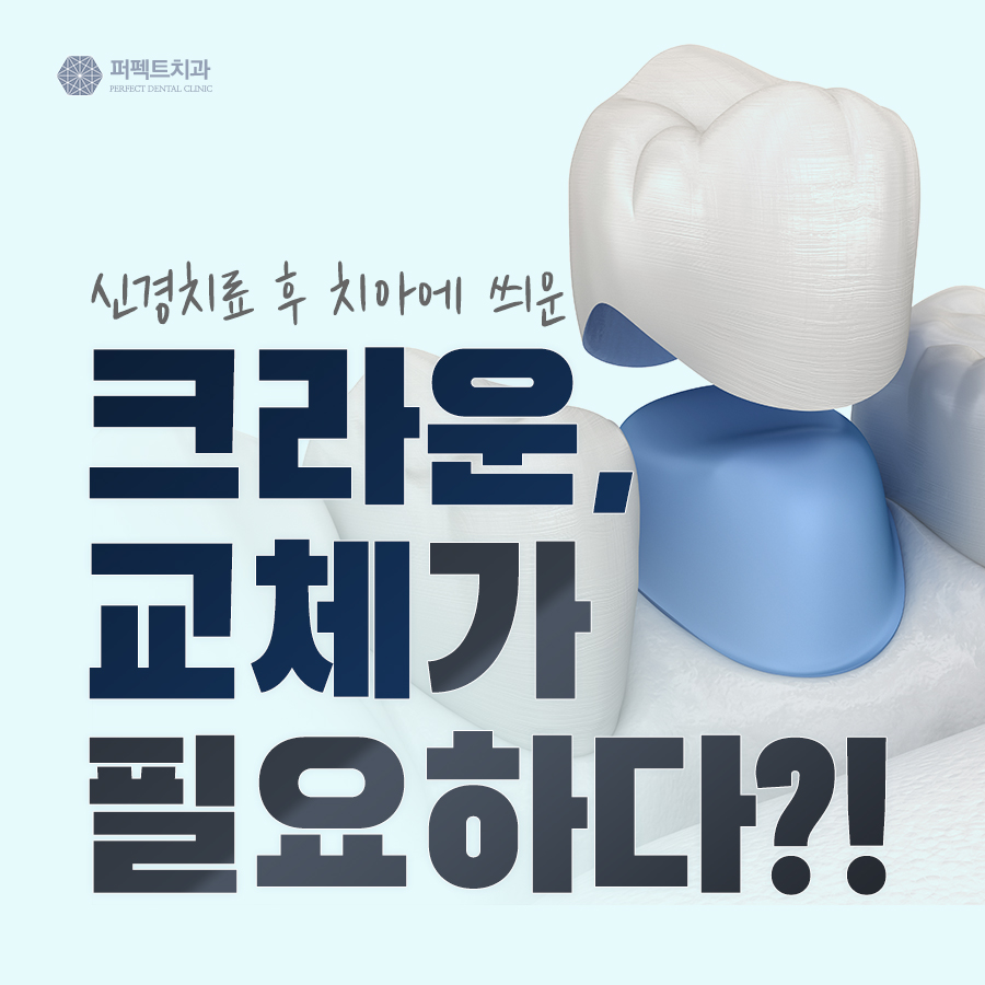 치아에 씌운 크라운 보철, 이런 경우 크라운교체가 필요하다! 관련 이미지 1
