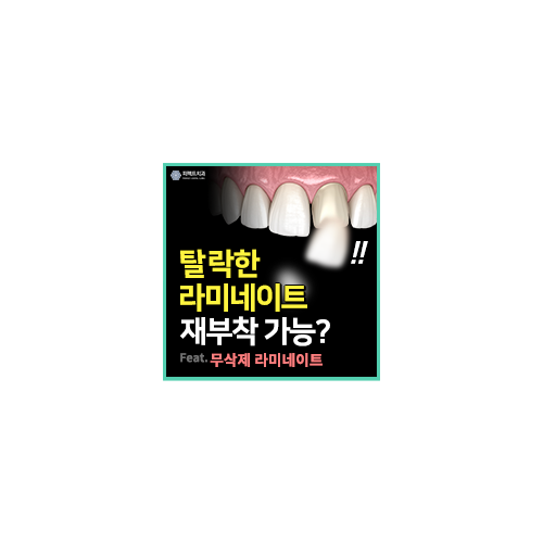 떨어진 라미네이트 재시술 가능? 관련 이미지 8