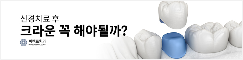 신경치료가 필요한 경우 / 통증,과정,크라운 관련 이미지 3