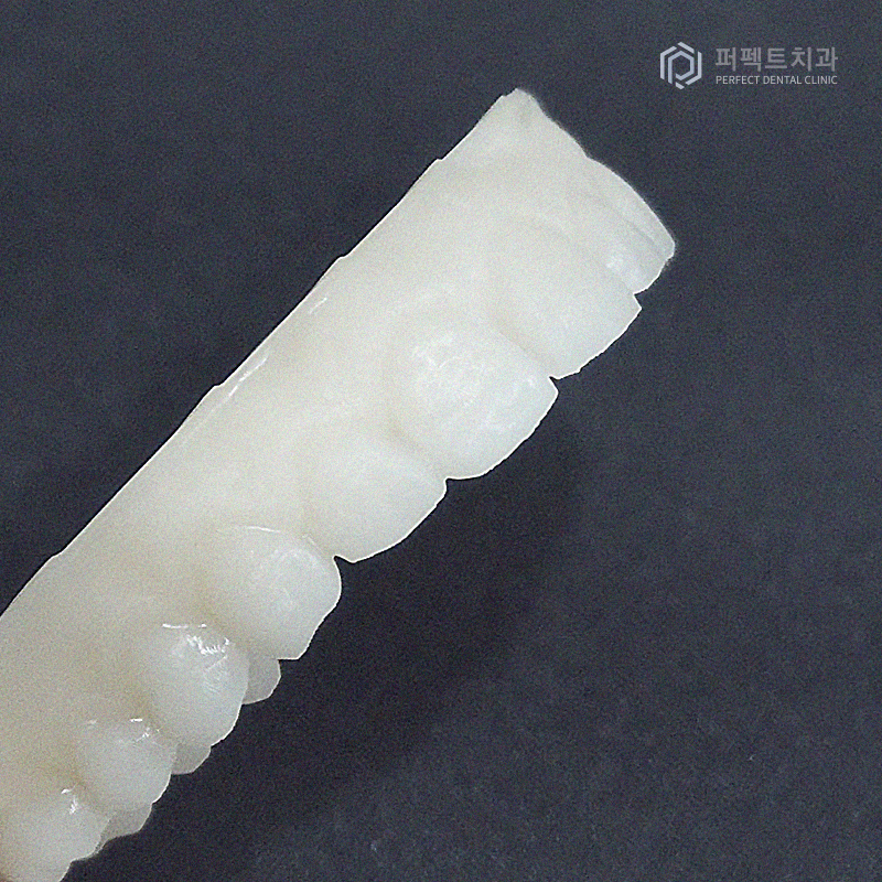 라미네이트는 무조건 얇을 게 좋을까? 관련 이미지 3