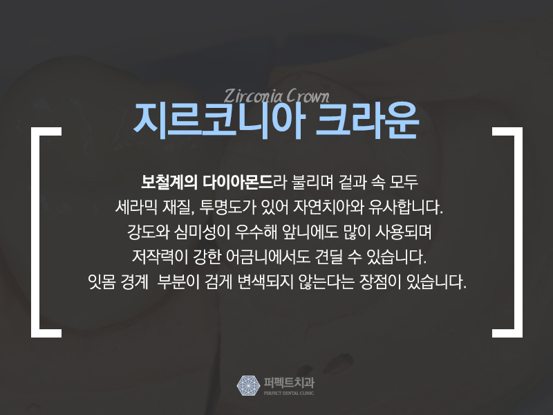 보철치료 종류와 비용 관련 이미지 3