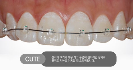 고민되는 부분만 집중적으로 부분교정 하자! 관련 이미지 3