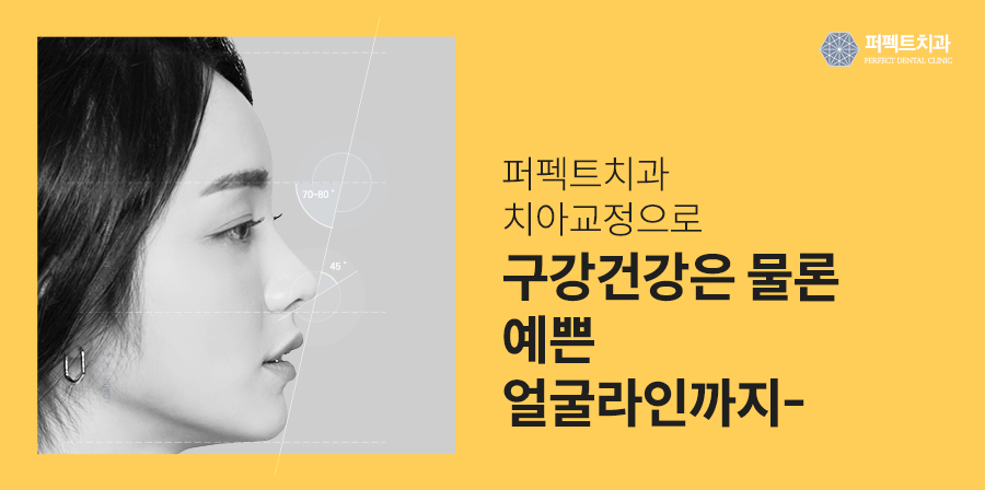 블랙트라이앵글, 치아교정의 부작용일까? 관련 이미지 6