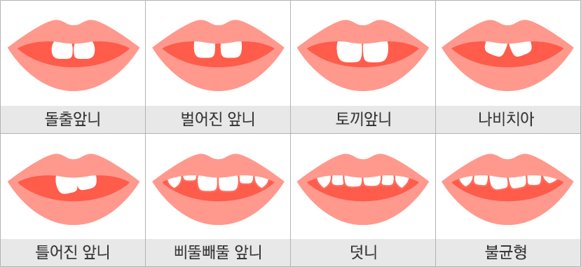고민되는 부분만 집중적으로 부분교정 하자! 관련 이미지 1