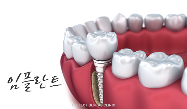 상실한 치아 어떻게 해야하나? 관련 이미지 4