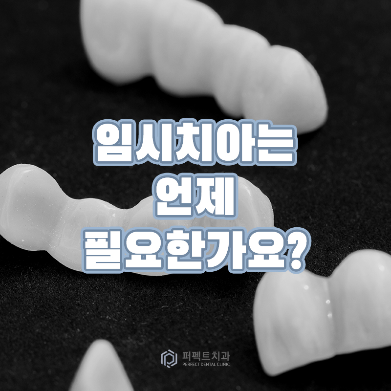 임시치아 시리즈#1 임시치아는 언제 필요한가요? 관련 이미지 1