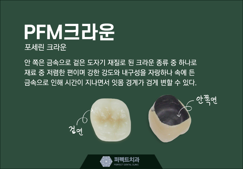 지르코니아크라운 저렴하게 할 수 있어! 관련 이미지 5