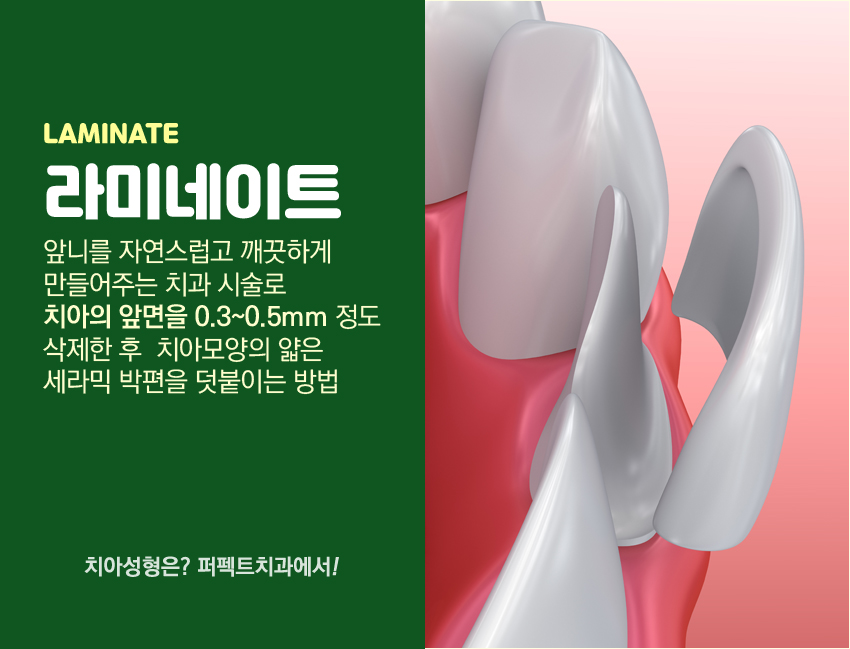 앞니성형 믿고 할 수 있는 치과! 관련 이미지 1