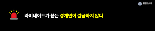 무삭제라미네이트 치료의 문제점? 관련 이미지 4