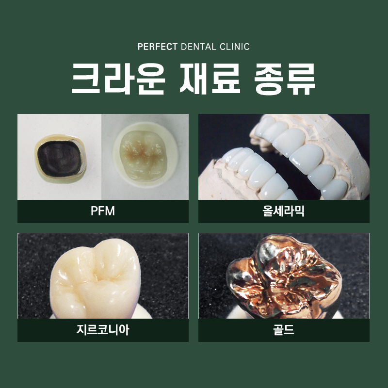 지르코니아크라운 저렴하게 할 수 있어! 관련 이미지 3