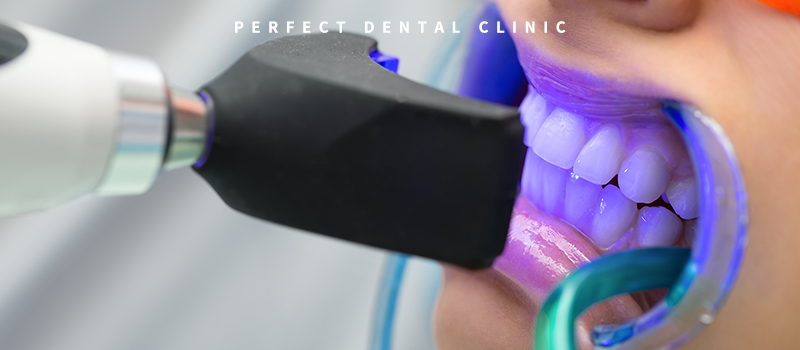 전문가 치아미백 가격얼마? 관련 이미지 3