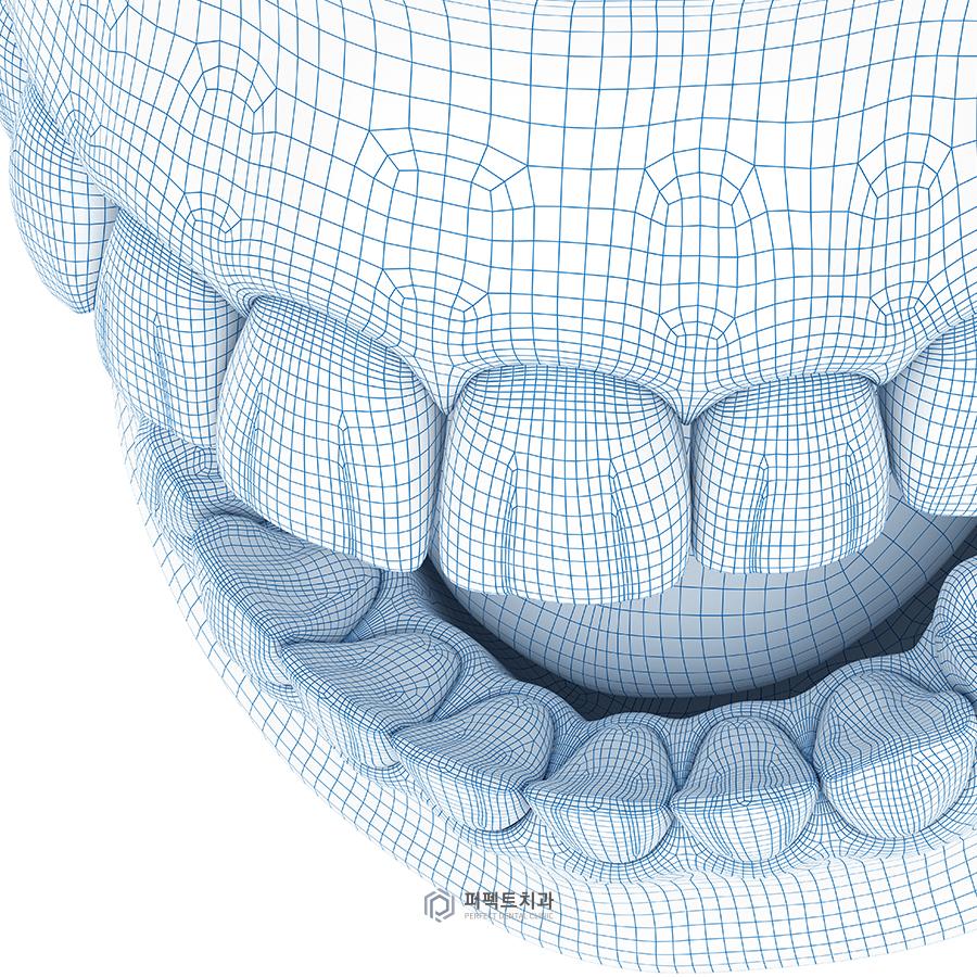 임시치아 시리즈 #2, 임시치아의 장점/통증/제작 기간은? 관련 이미지 4