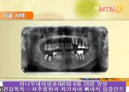MTN 건강톡톡 방송장면^^ 관련 이미지 11