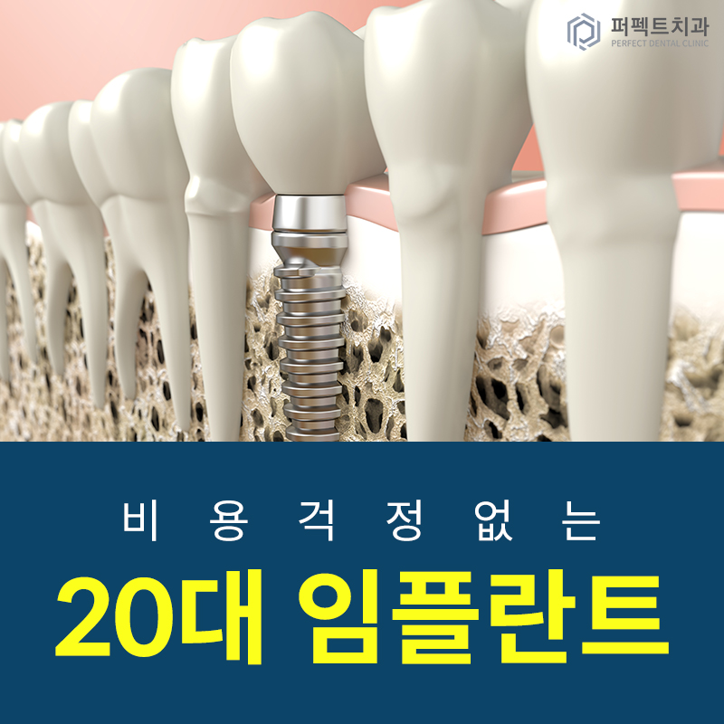 20대 임플란트 망설이지 마세요! 관련 이미지 1