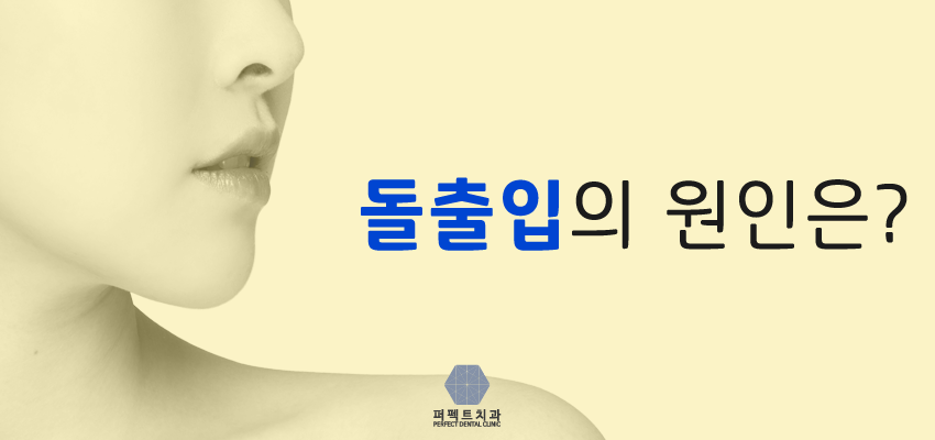 돌출입교정 퍼펙트치과 관련 이미지 4