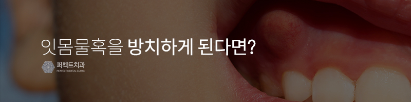 잇몸물혹 방치하게 되면? 관련 이미지 2