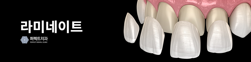 라미네이트와 올세라믹 차이점은? 관련 이미지 2