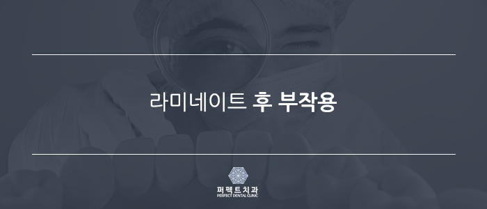 라미네이트 수명 영구적이다? 관련 이미지 5