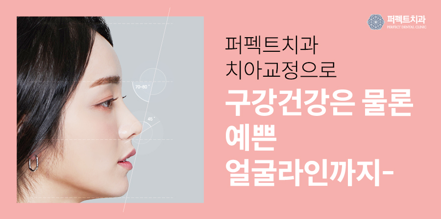 덧니교정,발치 꼭 해야되나요? 관련 이미지 6