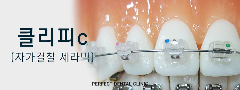 퍼펙트치과 전체교정 비용 궁금해? 관련 이미지 2
